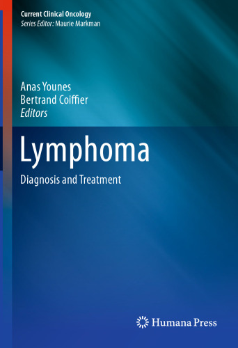 Lymphoma: Diagnosis and Treatment