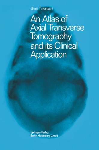 An Atlas of Axial Transverse Tomography and its Clinical Application