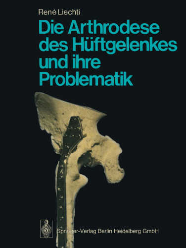 Die Arthrodese des Huftgelenkes und ihre Problematik