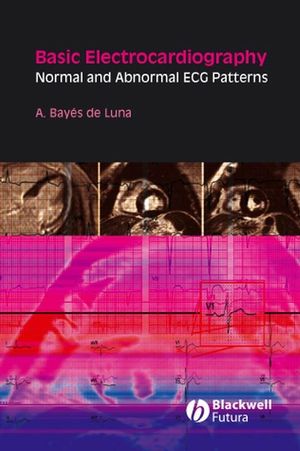 Basic Electrocardiography: Normal and Abnormal ECG Patterns